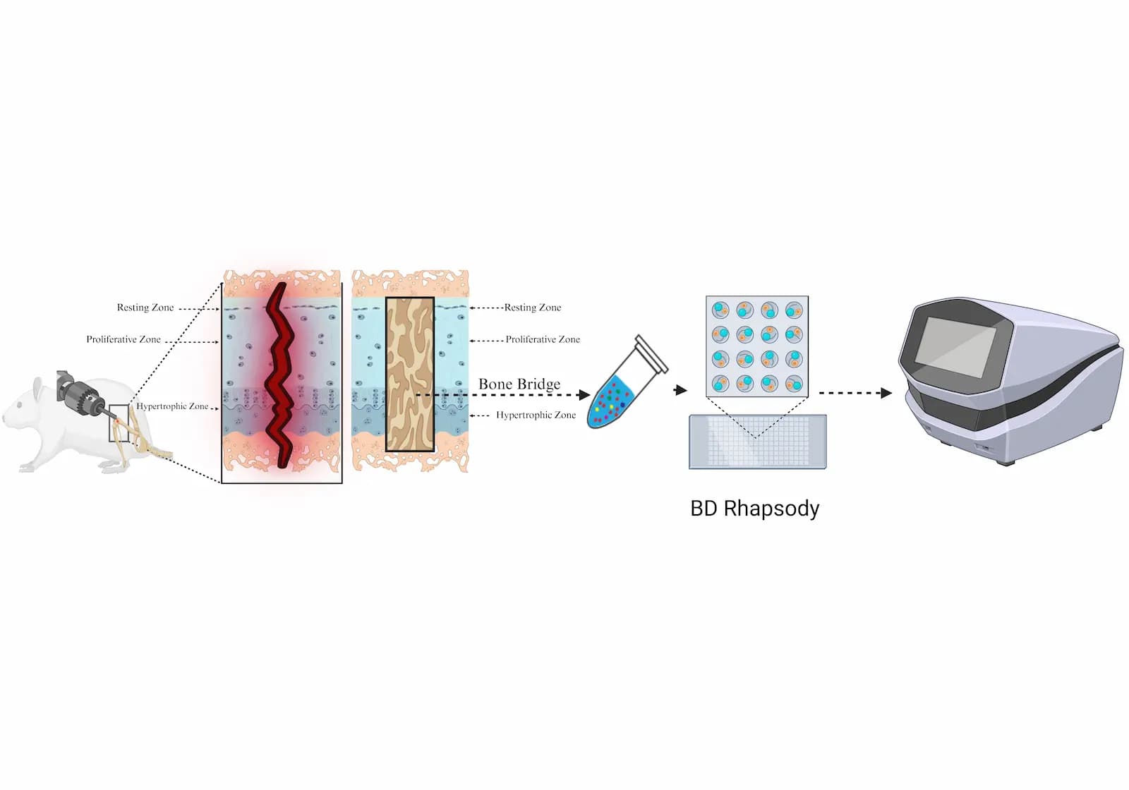 Bone bridge calcification sample overview