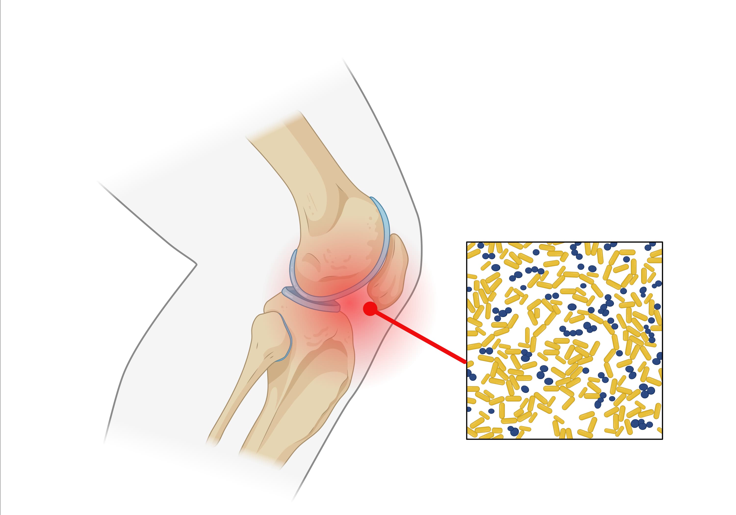 膝关节第一张 image