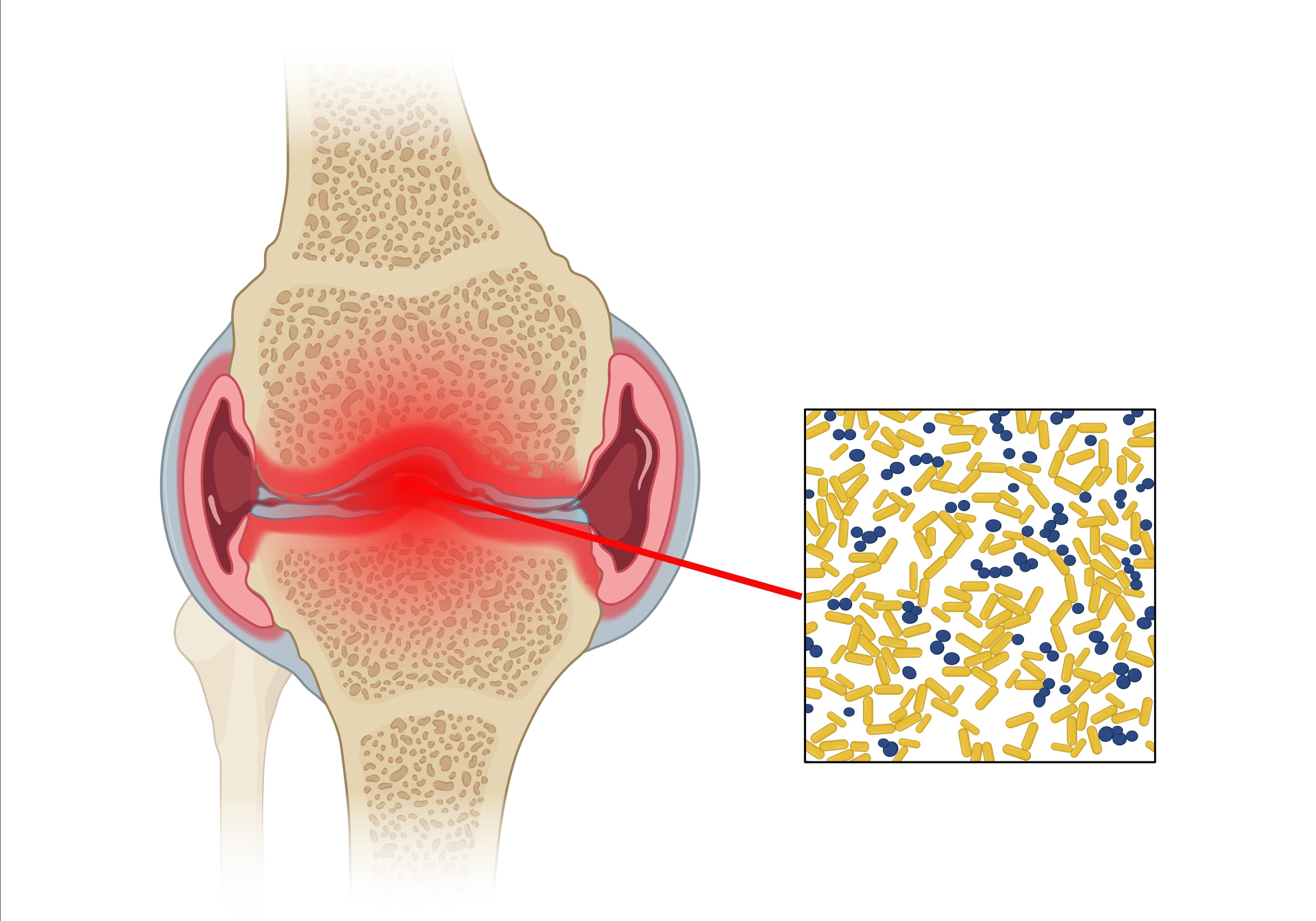 膝关节第三张 image