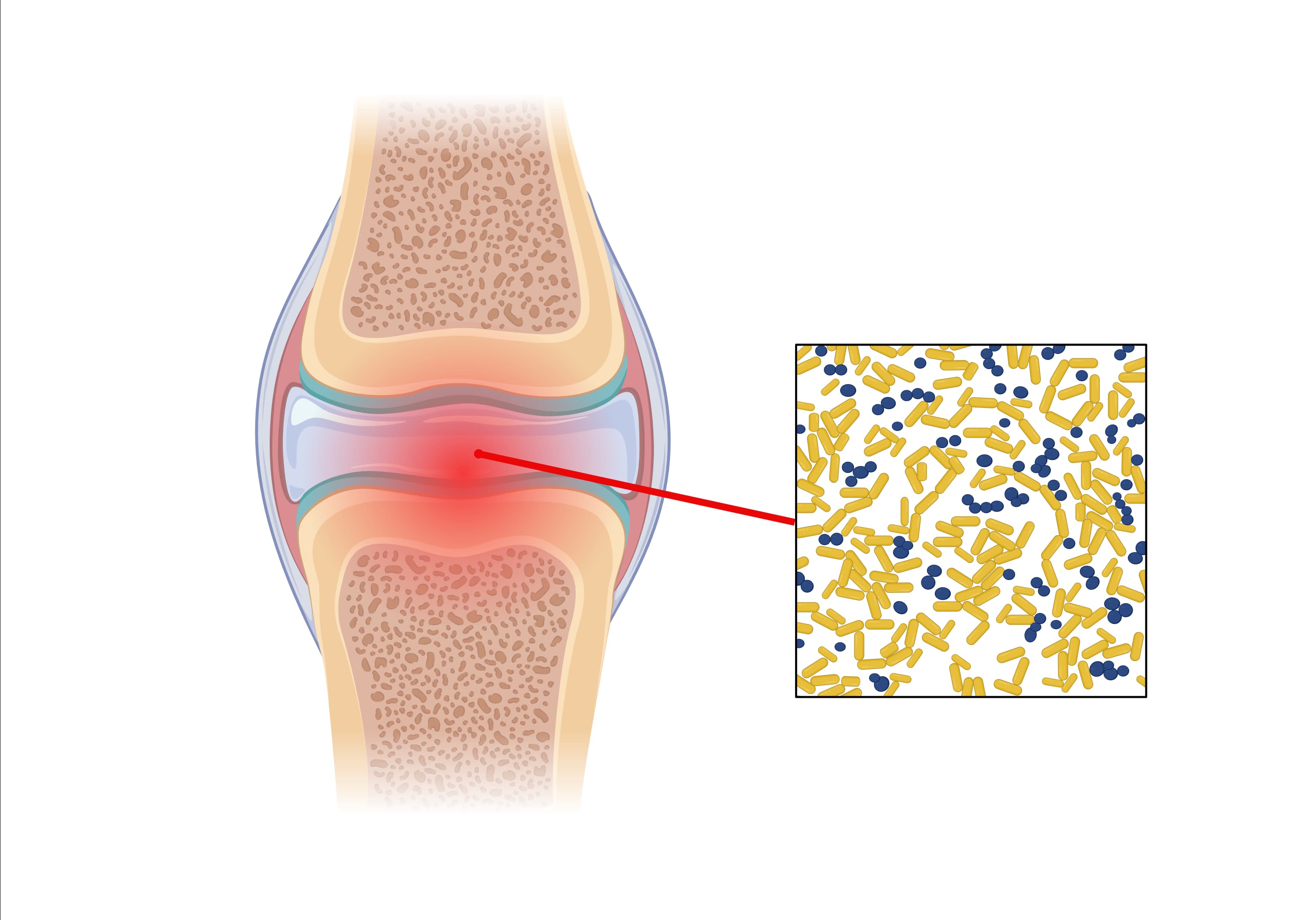 膝关节第二张 image